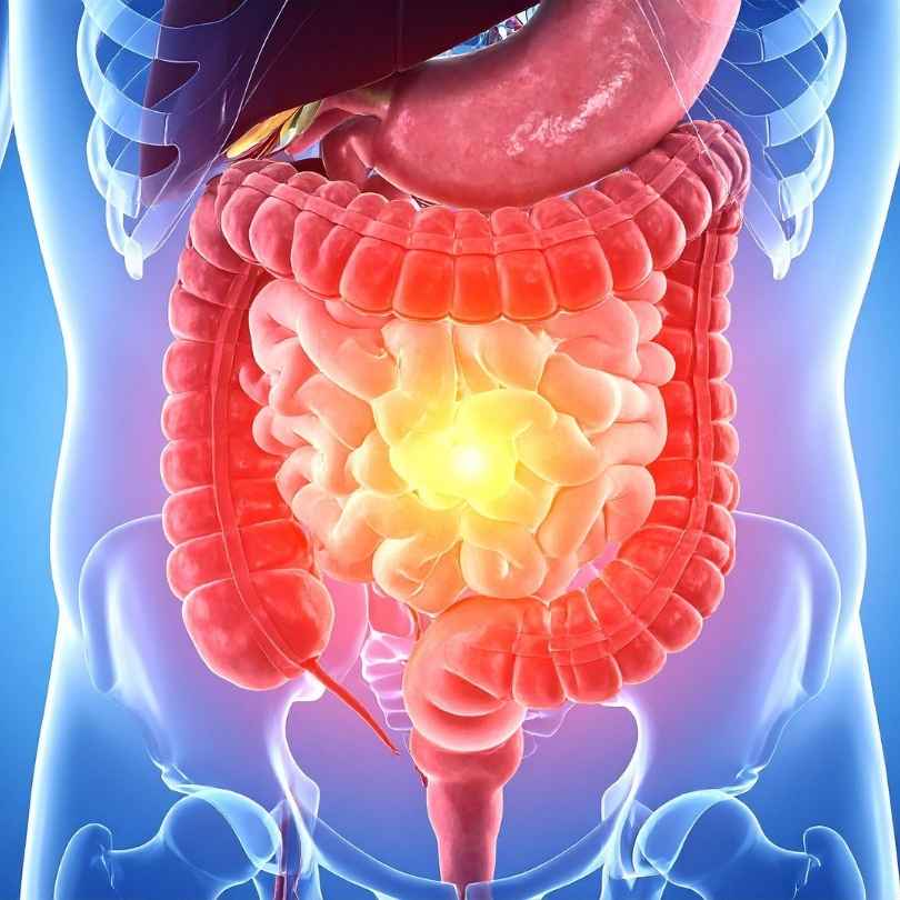 Gut Health